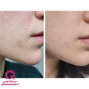 تونر گلیکولیک اسید 7 درصد اوردینری