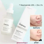 سرم نیاسینامید اوردینری ضد جوش مدل 1% Niacinamide 10% zink