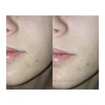 تونر روزانه روشن کننده AHA-BHA ویتامین سی کوزارکس 150 میل COSRX AHA-BHA Vitamin C Daily Toner - Image 2
